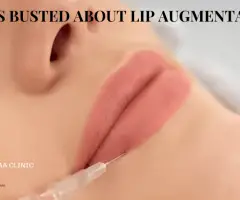 Myths Busted About Lip Augmentation