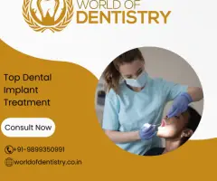 Top Dental Implant Treatment